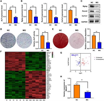 LncRNA MALAT1 mediates osteogenic differentiation in osteoporosis by regulating the miR-485-5p/WNT7B axis